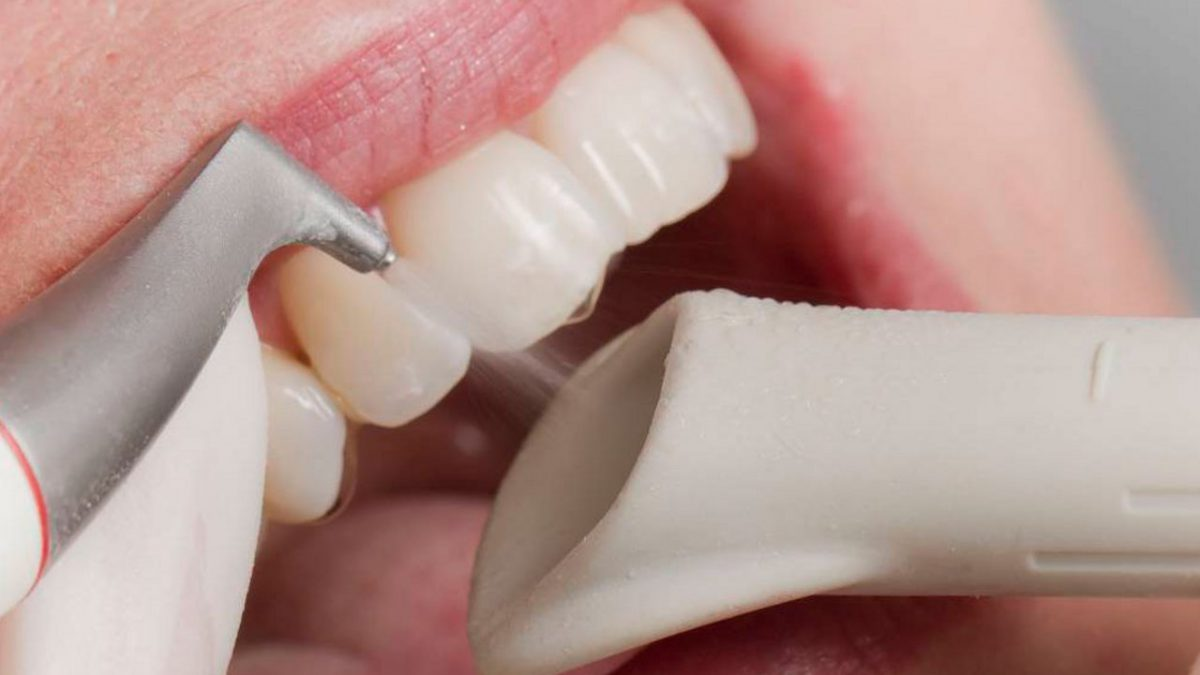 Больно ли делать чистку зубов?